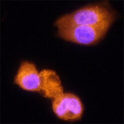 Human alpha-L-Iduronidase/IDUA Antibody, R D Systems 100&mu;g; Unlabeled:Antibodies,