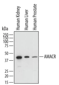 Human alpha-Methylacyl-CoA Racemase/AMACR Antibody, R D Systems 25&mu;g;