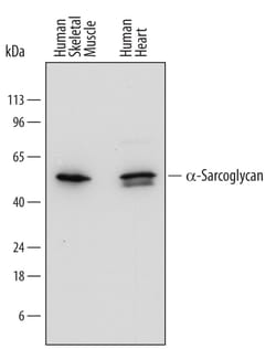 Human alpha-Sarcoglycan Antibody, R D Systems 25&mu;g; Unlabeled:Antibodies,