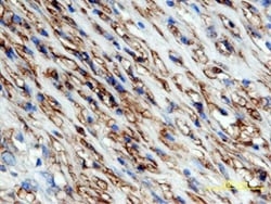 Human/Mouse/Rat alpha-Smooth Muscle Actin Antibody, R D Systems 100ug;