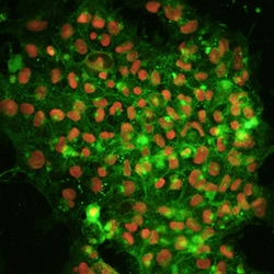 Human Alkaline Phosphatase/ALPL Antibody, R D Systems 100ug; Unlabeled:Antibodies,