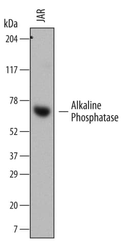 Human Alkaline Phosphatase/ALPP Antibody, R D Systems 25&mu;g; Unlabeled:Antibodies,