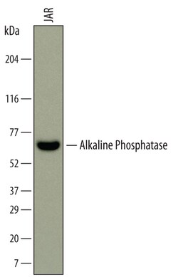 Human Alkaline Phosphatase/ALPP Antibody, R D Systems 100ug; Unlabeled:Antibodies,