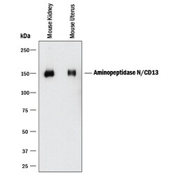 Mouse Aminopeptidase N/CD13 Antibody, R D Systems:Anticuerpos:Anticuerpos