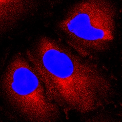 Human Aminopeptidase PILS/ARTS1 Antibody, R D Systems 100&mu;g; Unlabeled:Antibodies,
