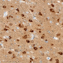 Human Amphiphysin/AMPH Antibody, R D Systems 25&mu;g; Unlabeled:Antibodies,
