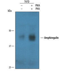 Human Amphiregulin Antibody, R D Systems 100&mu;g; Unlabeled:Antibodies,