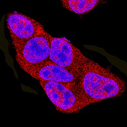 Human/Mouse/Rat AMPK alpha 2 Antibody, R D Systems 100&mu;g; Unlabeled:Antibodies,