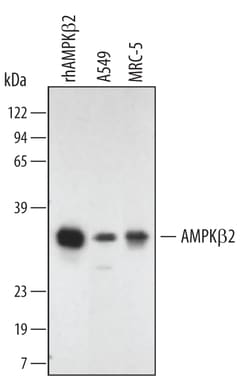 Human/Mouse AMPK beta 2 Antibody, R D Systems 25&mu;g; Unlabeled:Antibodies,
