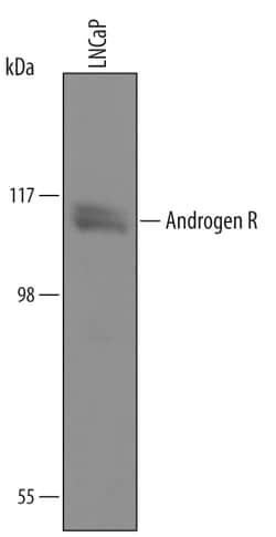 Human/Mouse/Rat Androgen R/NR3C4 Antibody, R D Systems 100&mu;g; Unlabeled:Antibodies,