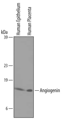 Human/Rat Angiogenin Antibody, R D Systems 25&mu;g; Unlabeled:Antibodies,