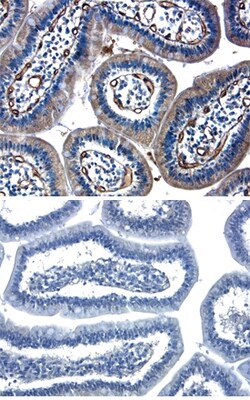 Human Angiopoietin-2 Antibody, R D Systems 25&mu;g; Unlabeled:Antibodies,