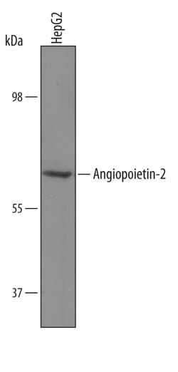Human Angiopoietin-2 Antibody, R D Systems 25&mu;g; Unlabeled:Antibodies,