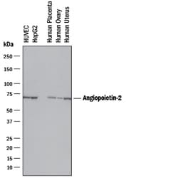 Human Angiopoietin-2 Antibody, R D Systems:Antibodies:Primary Antibodies