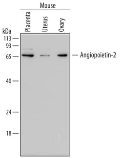 Mouse Angiopoietin-2 Antibody, R D Systems 25&mu;g; Unlabeled:Antibodies,
