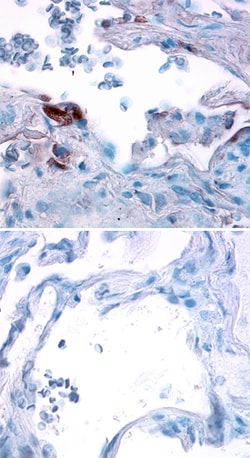 Human Angiopoietin-4 Antibody, R D Systems 25&mu;g; Unlabeled:Antibodies,