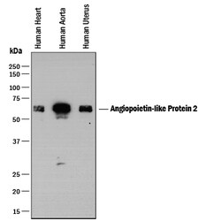 Angiopoietin-like Protein 2/ANGPTL2 Goat anti-Human, Polyclonal, R D Systems