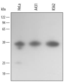 Human Annexin A10 Antibody, R D Systems 100&mu;g; Unlabeled:Antibodies,