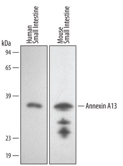 Human/Mouse Annexin A13 Antibody, R D Systems 25&mu;g; Unlabeled:Antibodies,
