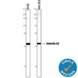 Human/Mouse/Rat Annexin A2 Antibody, R D Systems 100&mu;g; Unlabeled:Antibodies,