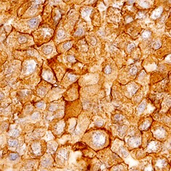 Human/Mouse/Rat Annexin A2 Antibody, R D Systems 100ug; Unlabeled:Antistoffer