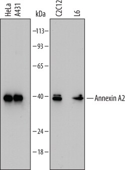 Human/Mouse/Rat Annexin A2 Antibody, R D Systems 100ug; Unlabeled:Antistoffer
