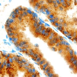 Human Annexin A3 Antibody, R D Systems 100ug; Unlabeled:Antibodies, Monoclonal