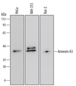 Human Annexin A3 Antibody, R D Systems 100ug; Unlabeled:Antibodies, Monoclonal
