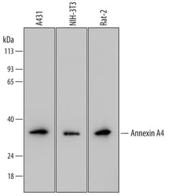 Human Annexin A4 Antibody, R D Systems 100ug; Unlabeled:Antibodies, Monoclonal