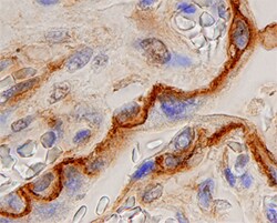 Human Annexin A6 Antibody, R D Systems 25&mu;g; Unlabeled:Antibodies, Monoclonal