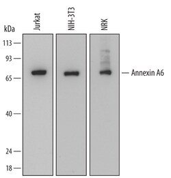 Human Annexin A6 Antibody, R D Systems 25&mu;g; Unlabeled:Antibodies, Monoclonal