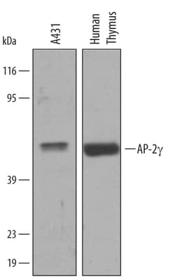 Human AP-2 gamma Antibody, R D Systems 25μg; Unlabeled:Antibodies, Polyclonal