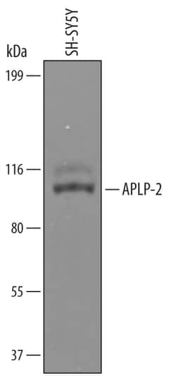 Human APLP-2 Antibody, R D Systems 100&mu;g; Unlabeled:Antibodies, Polyclonal