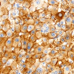 Human Apolipoprotein B/ApoB Antibody, R D Systems 100&mu;g; Unlabeled:Antibodies,