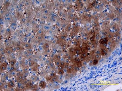 Human Apolipoprotein B/ApoB Antibody, R D Systems 100ug; Unlabeled:Antibodies,