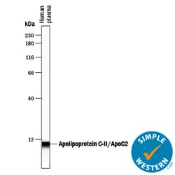 Human Apolipoprotein C-II/ApoC2 Antibody, R D Systems 100&mu;g; Unlabeled:Antibodies,