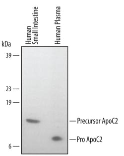 Human Apolipoprotein C-II/ApoC2 Antibody, R D Systems 100&mu;g; Unlabeled:Antibodies,