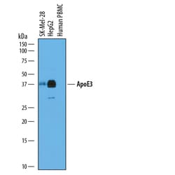 Human Apolipoprotein E/ApoE Antibody, R D Systems 25&mu;g; Unlabeled:Antibodies,