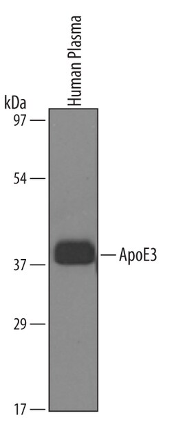 Human Apolipoprotein E/ApoE Antibody, R D Systems 25&mu;g; Unlabeled:Antibodies,