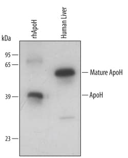 Human Apolipoprotein H/ApoH Antibody, R D Systems 25&mu;g; Unlabeled:Anticuerpos