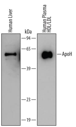 Human Apolipoprotein H/ApoH Antibody, R D Systems 25&mu;g; Unlabeled:Antibodies,