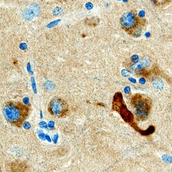 Human APP695+1 Antibody, R D Systems 25&mu;g; Unlabeled:Antibodies, Polyclonal