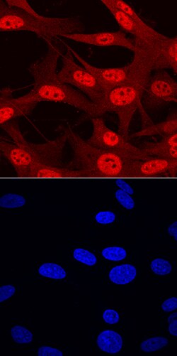 Human ARX Antibody, R D Systems 25&mu;g; Unlabeled:Antibodies, Polyclonal