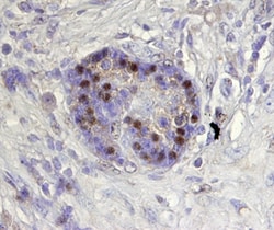 Human ARX Antibody, R D Systems 25&mu;g; Unlabeled:Antibodies, Polyclonal