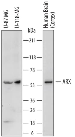 Human ARX Antibody, R D Systems 25&mu;g; Unlabeled:Antibodies, Polyclonal