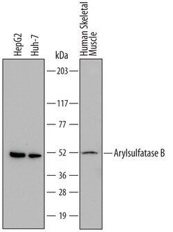 Human Arylsulfatase B/ARSB Antibody, R D Systems 25&mu;g; Unlabeled:Antibodies,
