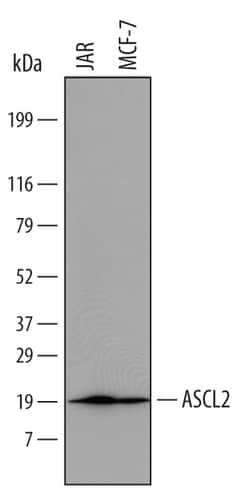 Human ASCL2/Mash2 Antibody, R D Systems 25&mu;g; Unlabeled:Antibodies,