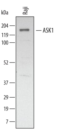 Human ASK1 Antibody, R D Systems 25&mu;g; Unlabeled:Antibodies, Polyclonal