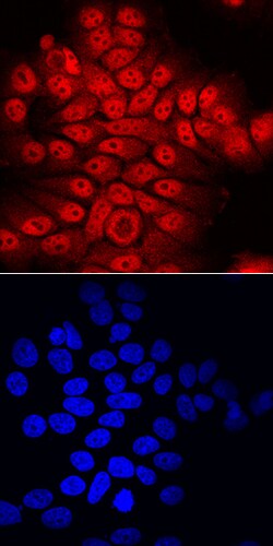Human ATBF1/ZFHX3 Antibody, R D Systems 25&mu;g; Unlabeled:Antibodies,