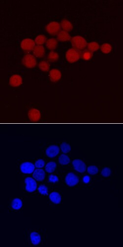 Human ATF4 Antibody, R D Systems 25 &mu;g | Buy Online | R&D Systems | Fisher Scientific